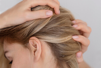 Найкращий шампунь від лупи